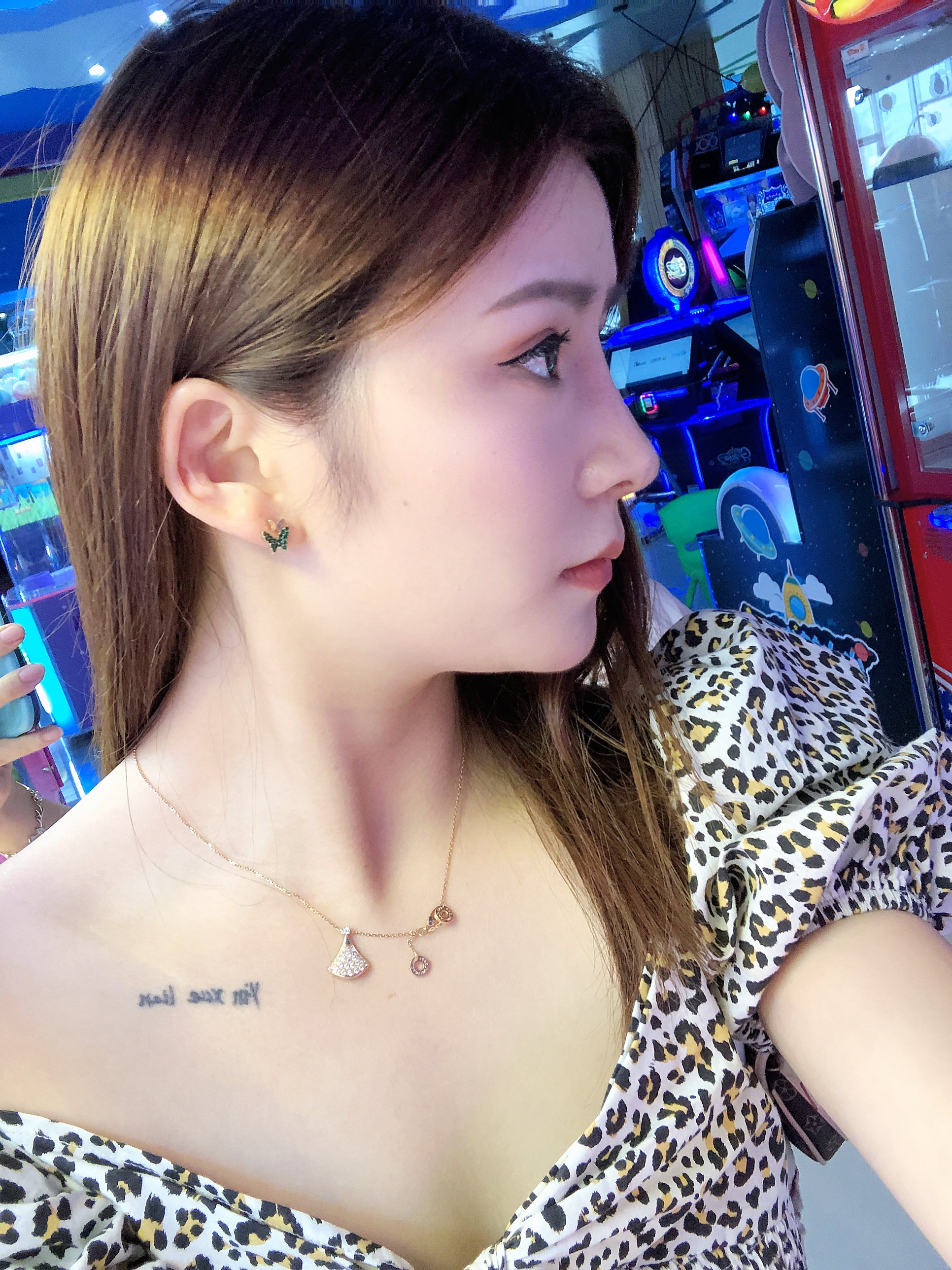 【膨体隆鼻 耳软骨垫鼻尖术后38天】