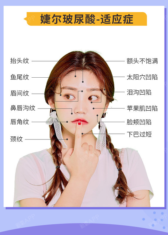 【玻尿酸】婕尔 婕尔玻尿酸 1ml ,【婕尔玻尿酸1ml 】塑形 填充二合一