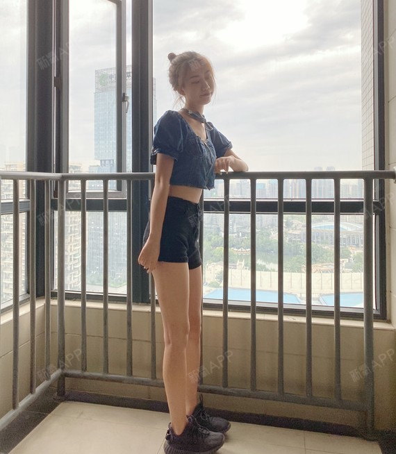 一,手术项目:大腿吸脂(术前照片)二,术后一个月效_圈子-新氧美容整形