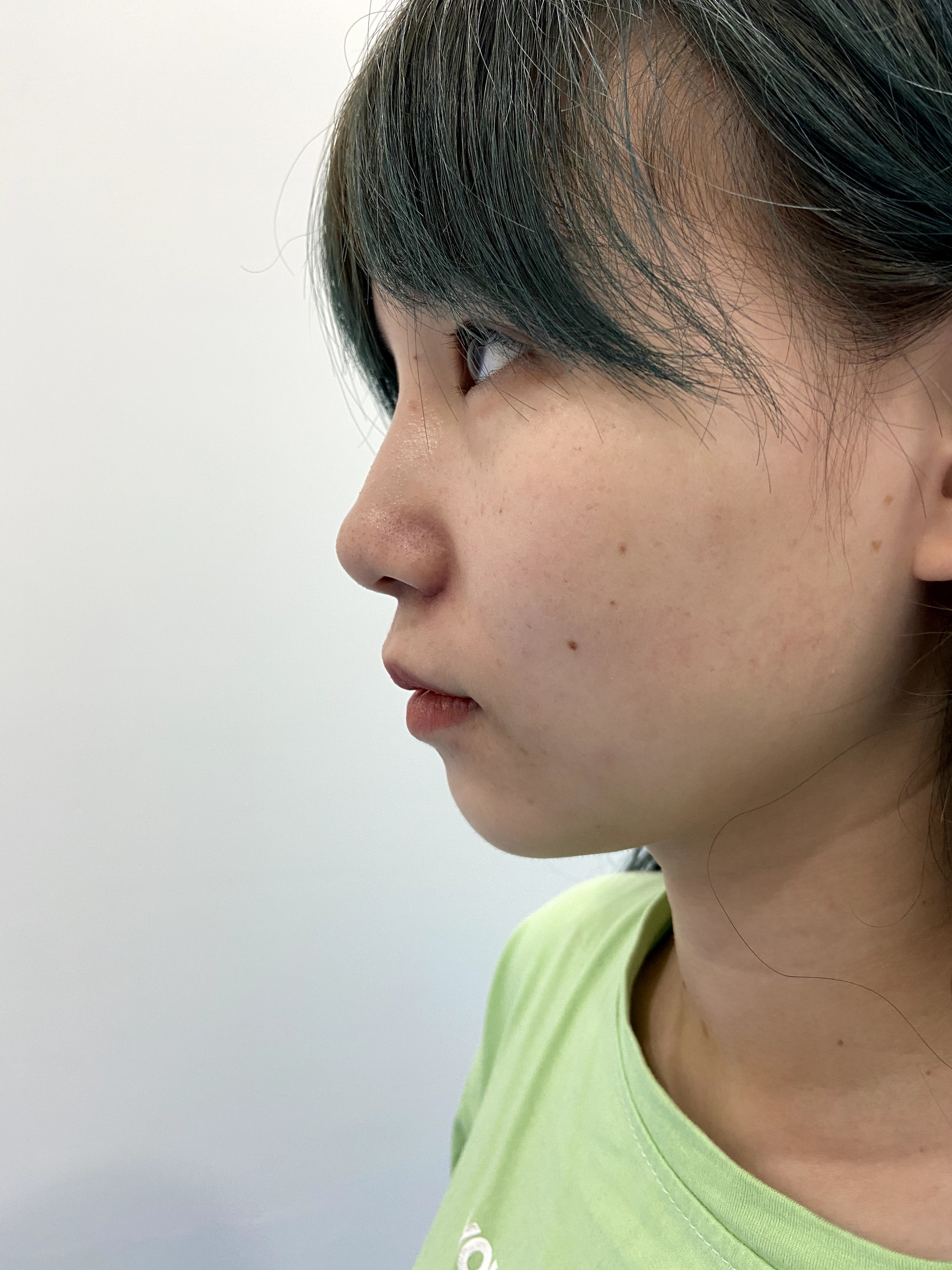 自己明明还是青春无敌的美少女但是却因为这个平坦的人中沟被叫了几次