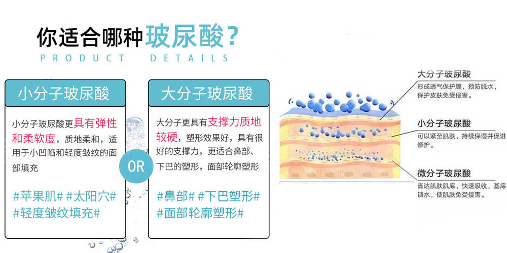 玻尿酸大分子小分子有什么区别?
