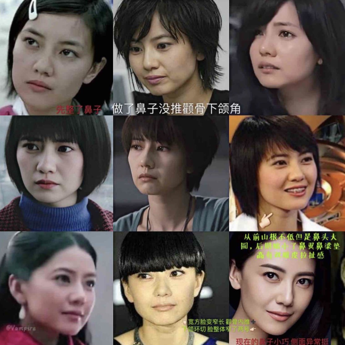 说高圆圆没整容的是瞎吧