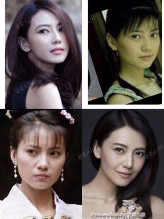 说高圆圆没整容的是瞎吧