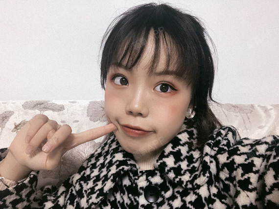 坚持做自己很cool我做的这个鼻子真心很秀气了,_圈子-新氧美容整形