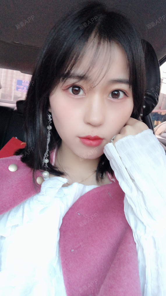 坚持做自己很cool自从拆线以后,鼻子是一天一个_圈子-新氧美容整形