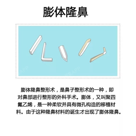 对于不同鼻部基础的隆鼻方式,从材料方面来分类,常见的有以下几种 1.