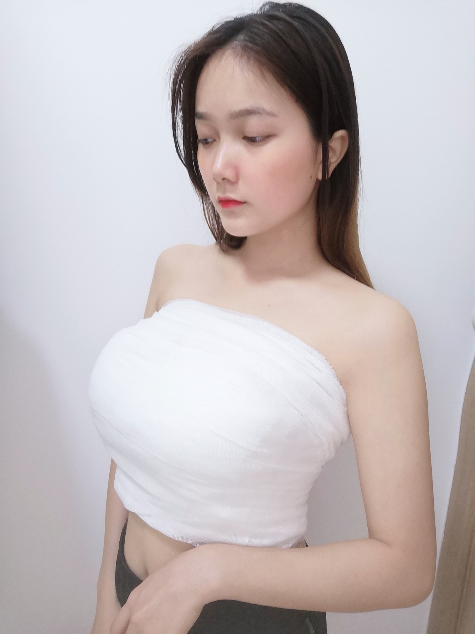 自体隆胸 女性图片