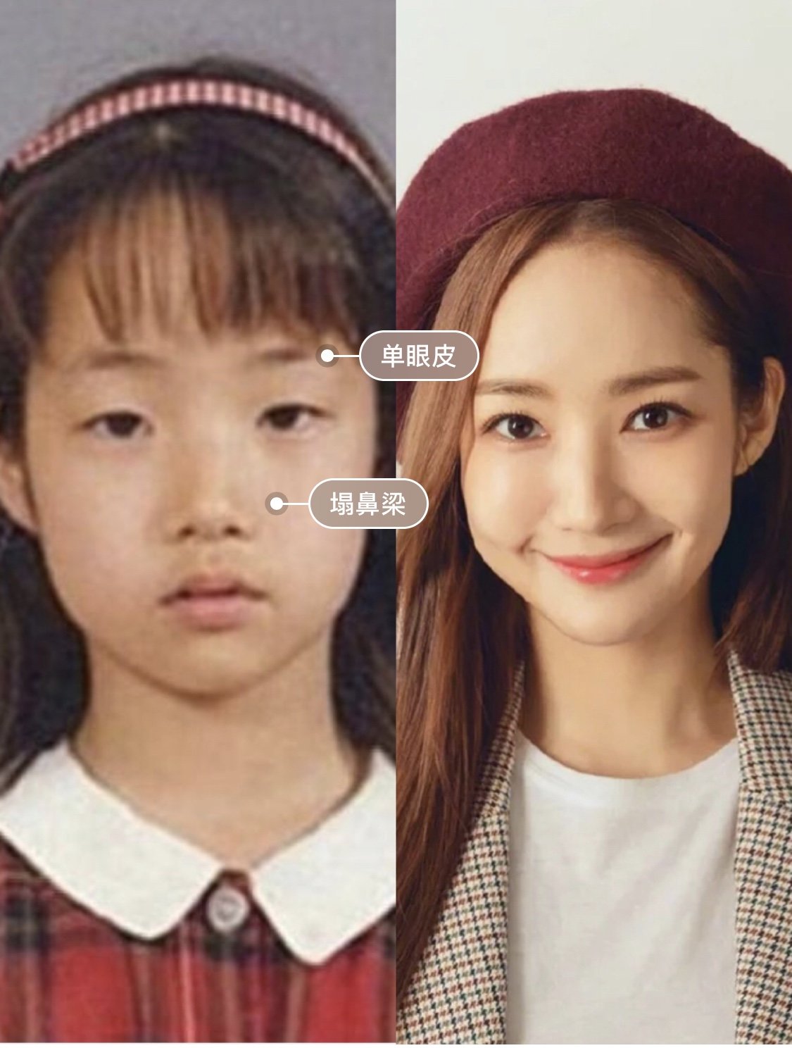 演技也很自然,而且她本人也十分坦率,非常直白地告诉大家自己整容了