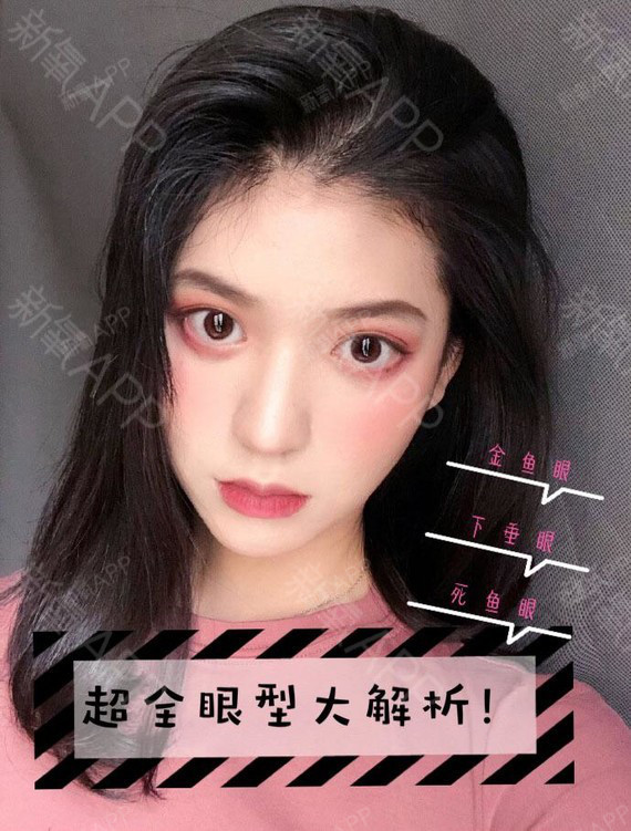 【金鱼眼,下垂眼,死鱼眼都有救了!—— 超全眼型大_圈子-新氧美容整形