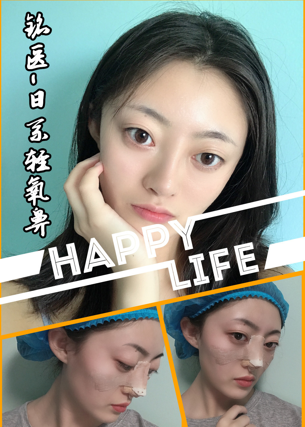 铭医日系轻氧鼻术后