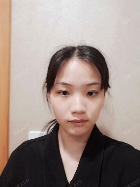 【杭州薇琳】瘦子的世界大家不懂,脸上没得啥肉肉,脸_圈子-新氧美容