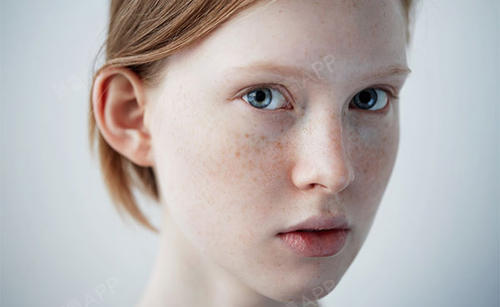 斑斑点点真的很讨厌,那么如何真正做对祛斑呢?