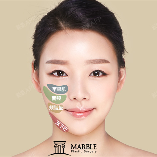 小v脸即上镜又好看,但_圈子-新氧美容整形