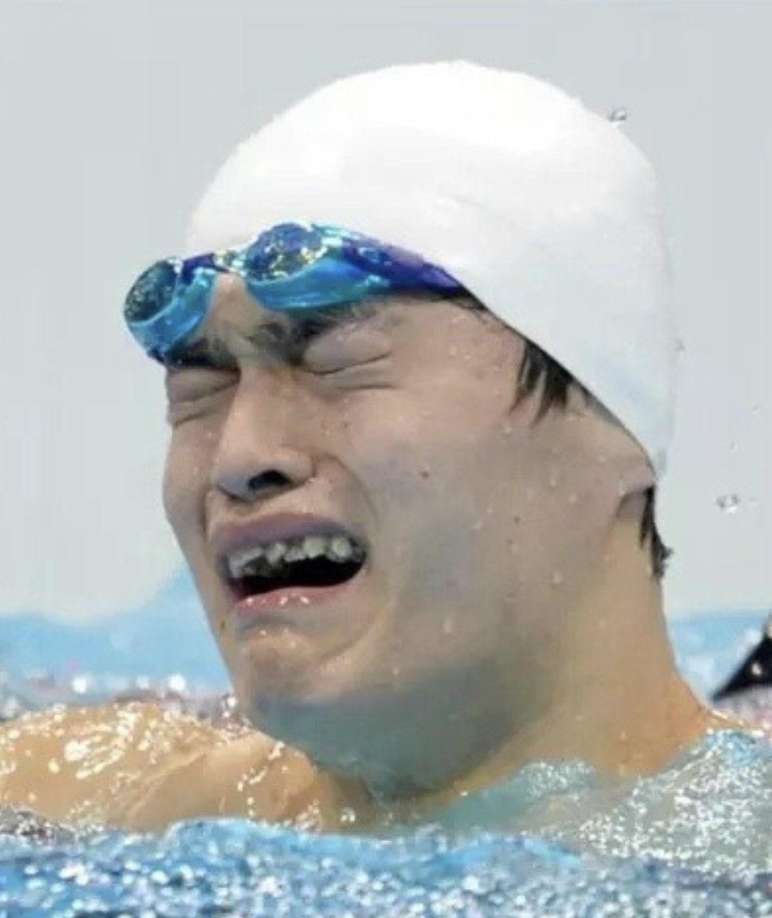 游泳健将孙杨牙齿矫正前后