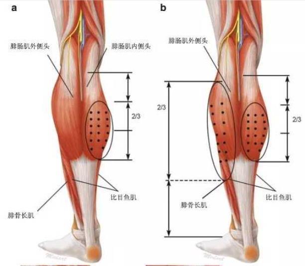 辣么努力减肥的你瘦下来了吗