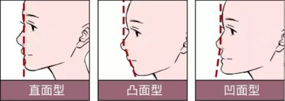 一般来说,人的侧面骨相区主要分为 直面型,凸面型,凹面型你是哪种呢?