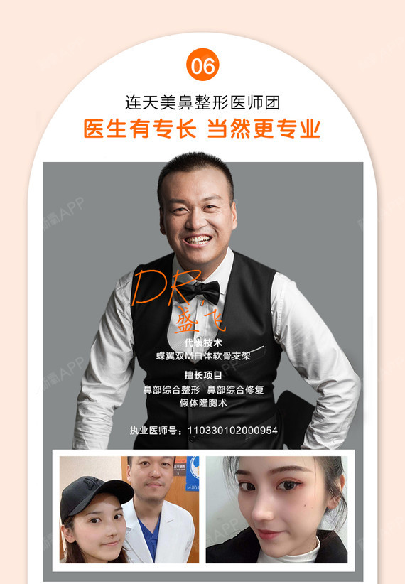 鼻部多项耳软骨复合隆鼻索康膨体耳软骨支架隆鼻