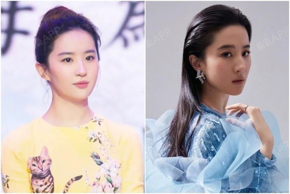 "脸包头""颅顶低"如何通过发型来调整?