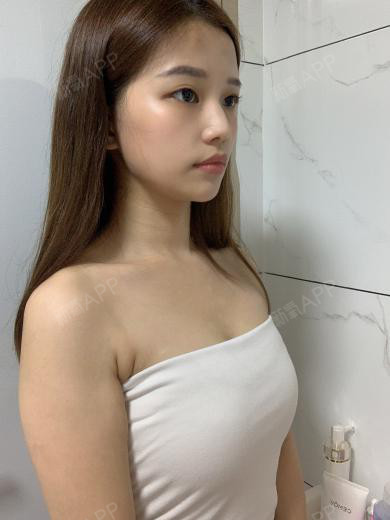 反精致美人做完啦~今天是第三天,没想到做胸这么简_圈子-新氧美容