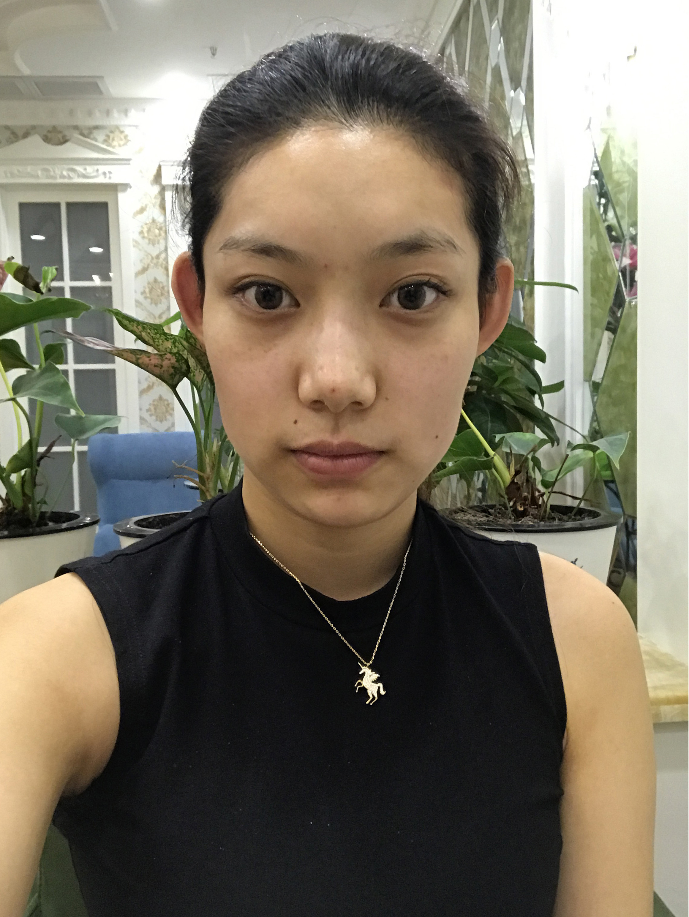 简直就面部凹陷女性下巴发黑图片山根两侧发黑脸色暗沉发黑黑眼圈下巴