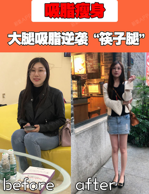 而能夠擁有細長勻稱的美腿,是每個女生不懈的追求,大腿肥胖的姑娘們