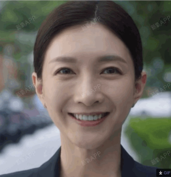 因为,江疏影的眼睛,一直都比较显老,因为她一直有一定程度的上睑提肌