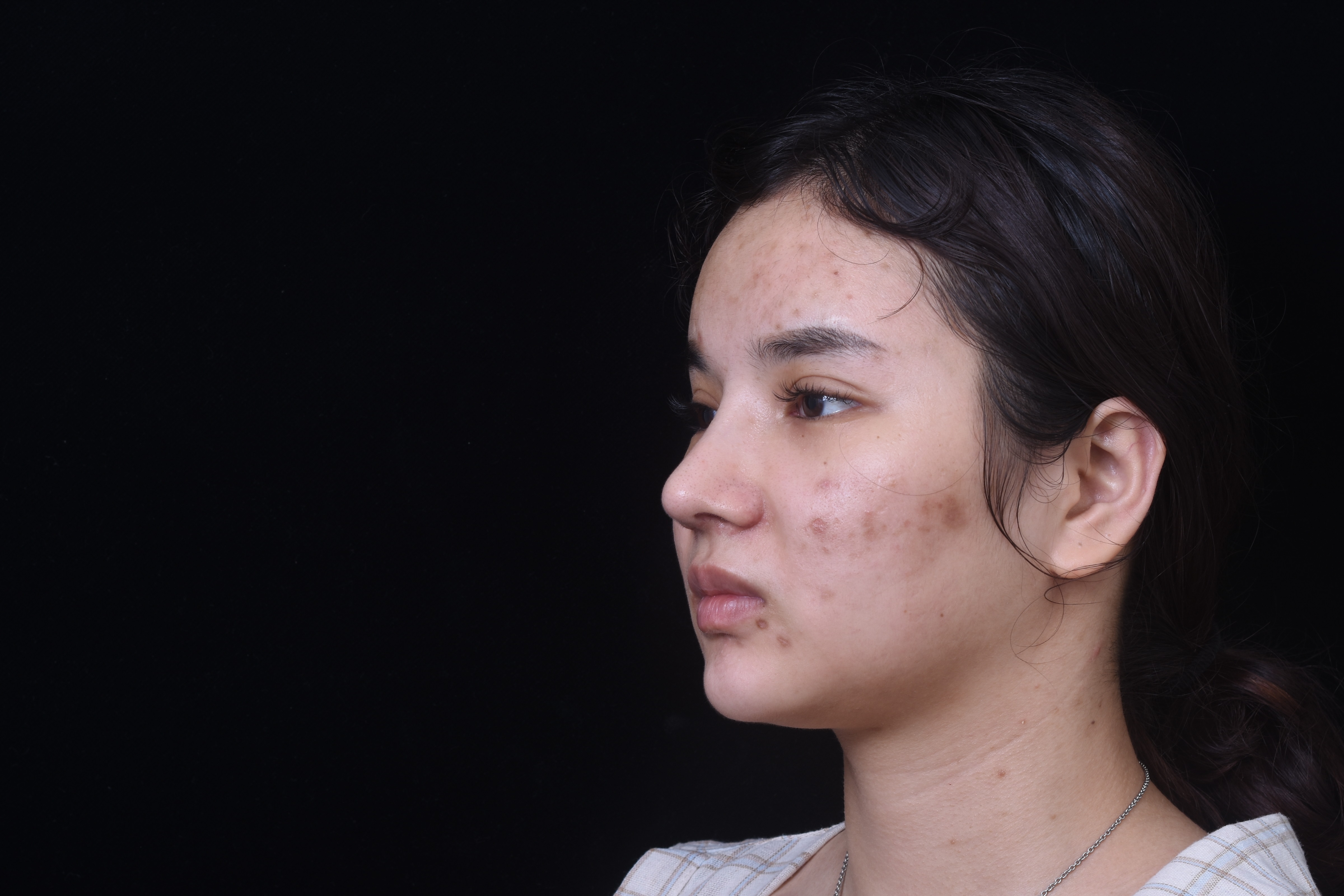 也是刚拆完线的样子,这个鼻_圈子-新氧美容整形