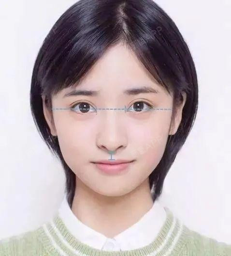 人中虽不起眼,但太长或太短都会影响面部美观 为了提_圈子-新氧美容