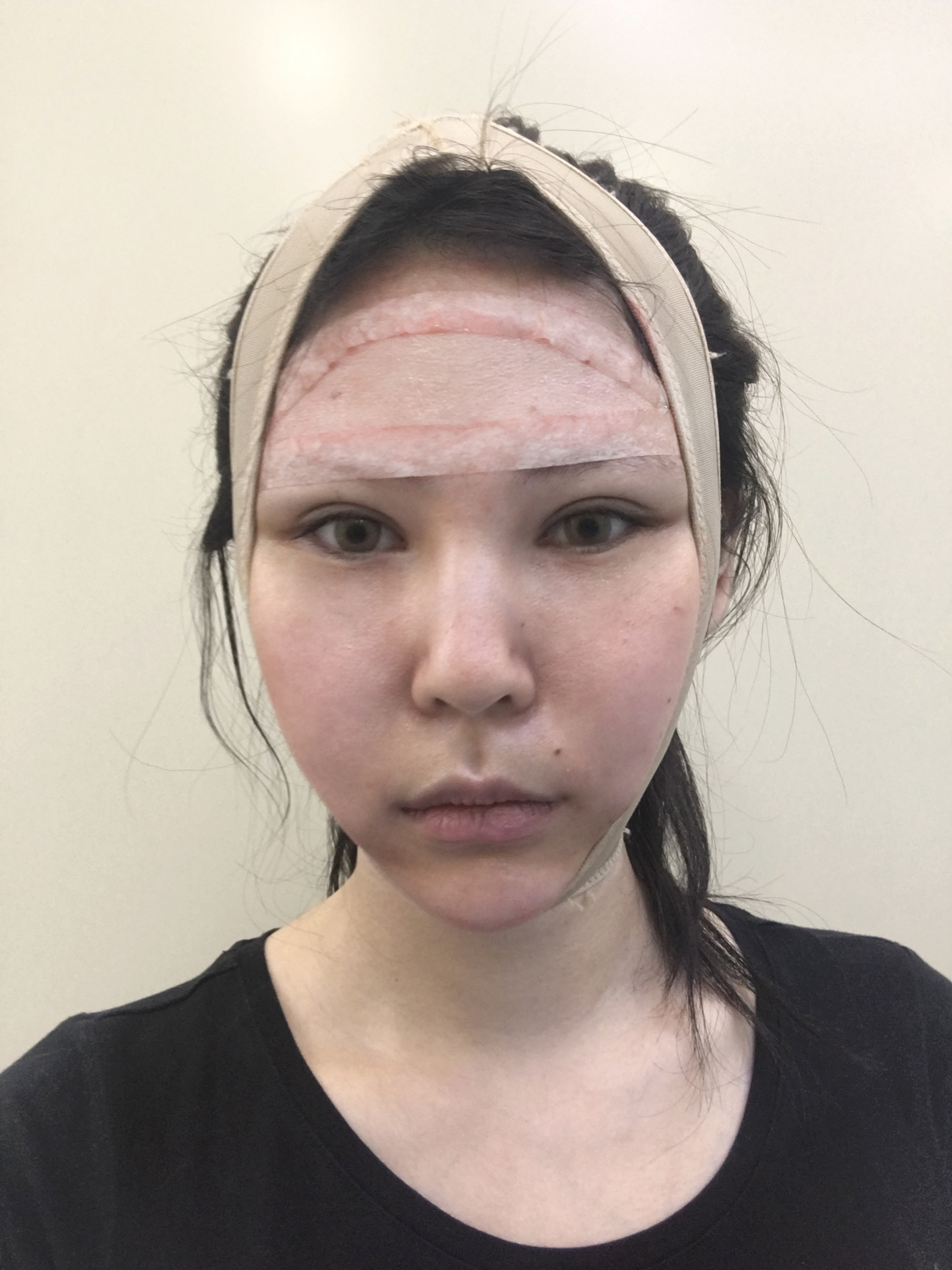90饱满圆润的面部,不仅会让脸型的线条更加自然柔和,_圈子-新氧美容