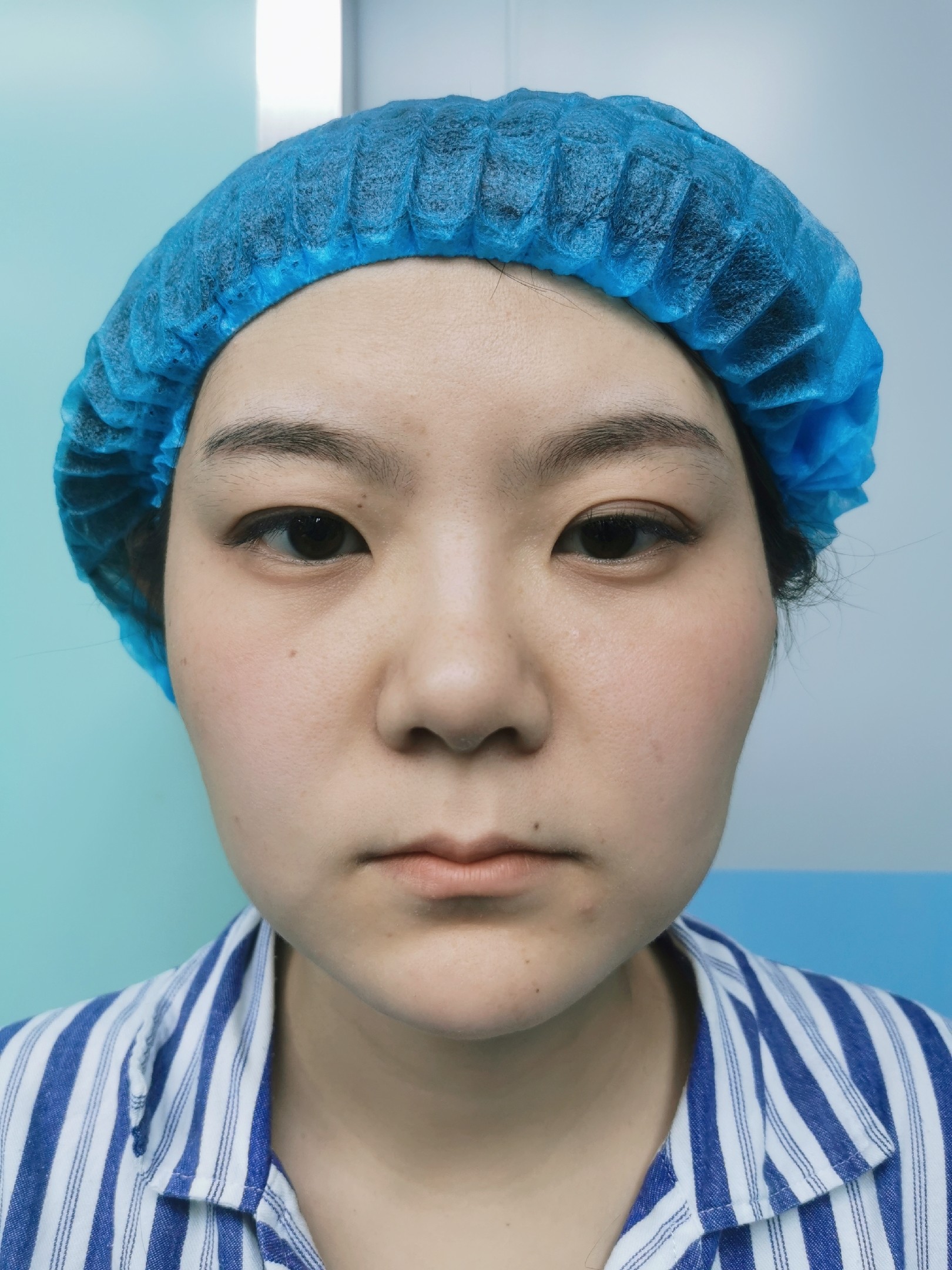 宝宝本身颧弓外扩,颧骨比较高