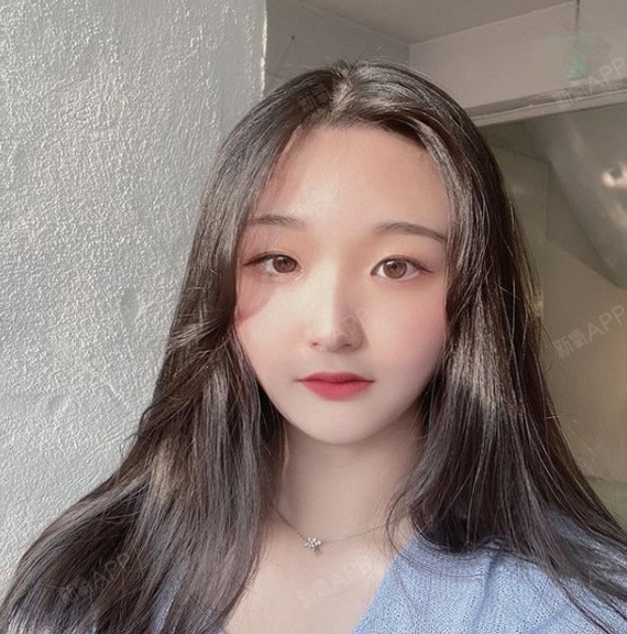 我觉得我打完瘦脸针第六天就有效果了,不知道是不是心_圈子-新氧美容