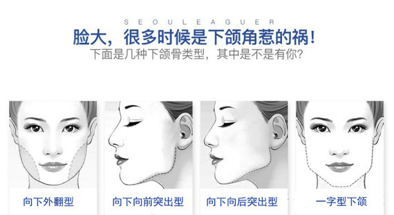 下颌角肥大分类:  下颌角后突型  下颌角外翻型  下颌角突出外翻型