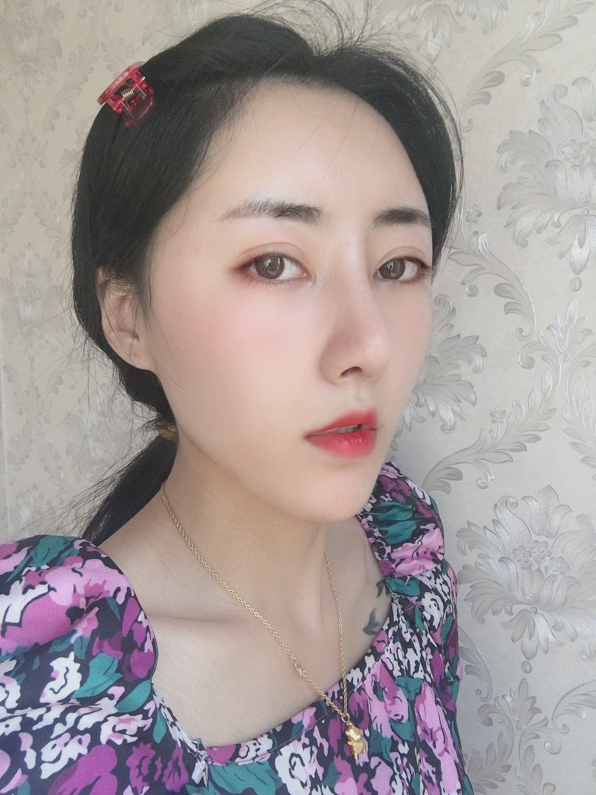 铭医日系轻氧鼻术后34天