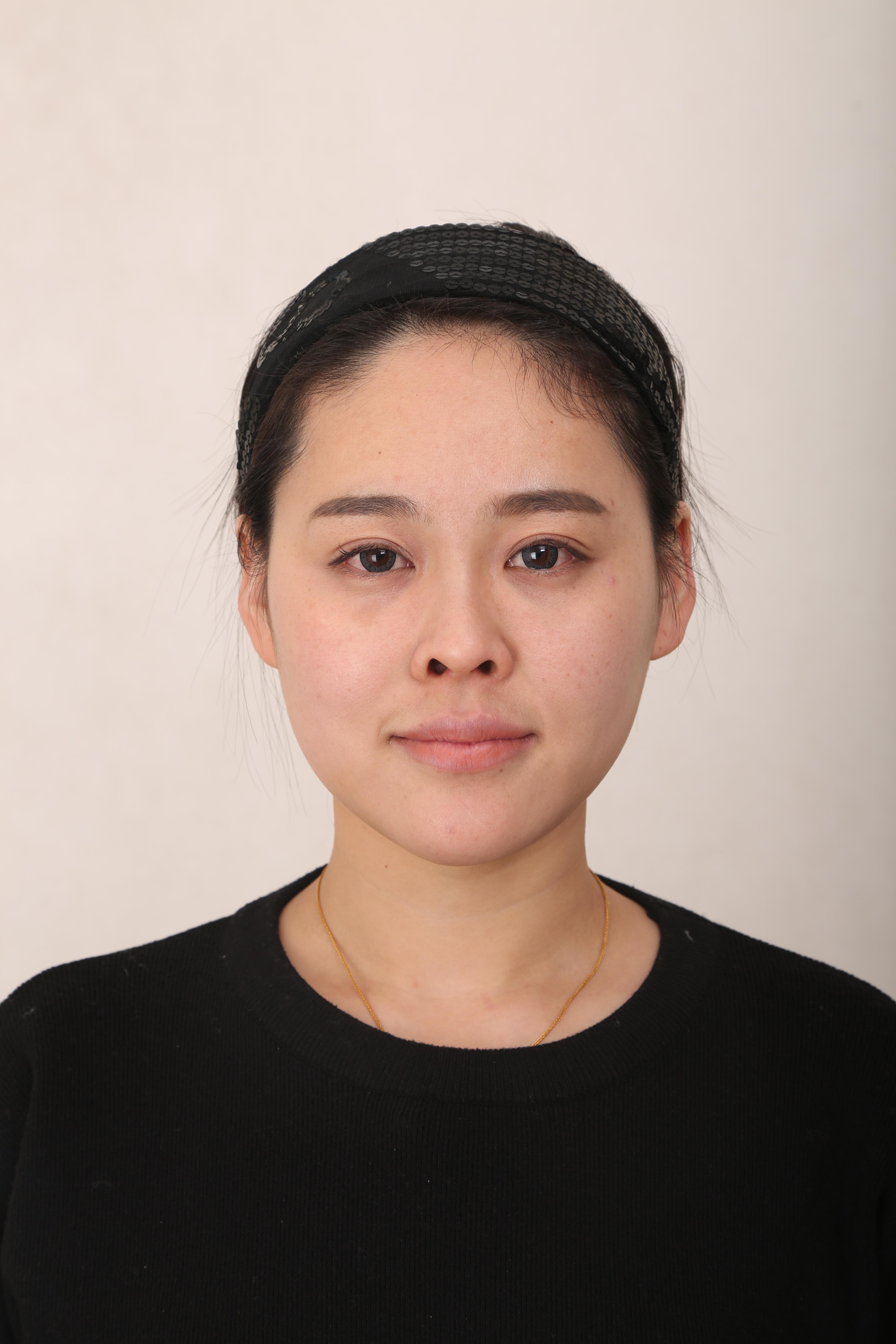 我一贯喜欢自然饱满的脸型,而我自身的脸型也不算糟糕,只是需要微调