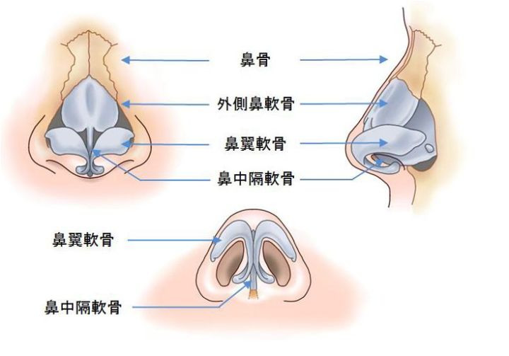 鼻骨宽真的是用鼻骨内推的方法解决?