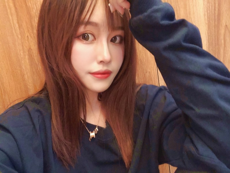 【石家庄美然鼻翼缩小术后第60天】我的鼻子明显鼻翼_圈子-新氧美容