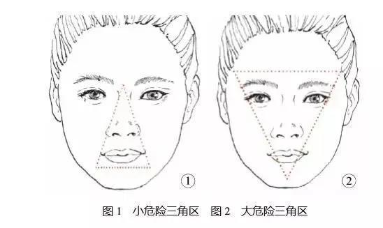 其实面部还有一个大三角,大危险三角区是指由额点向两外眦点连线向上