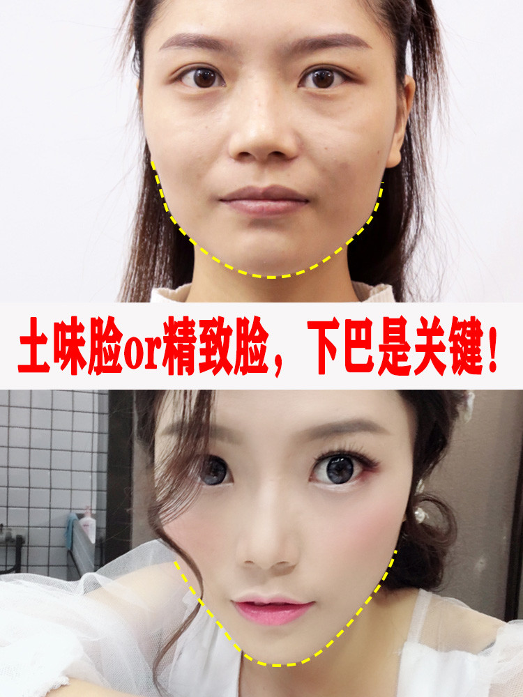 下巴短圆会破坏面部轮廓.