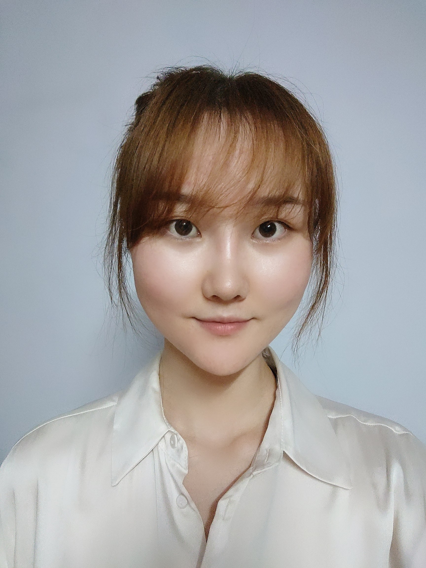 吉林铭医整形日系轻氧鼻术后49天