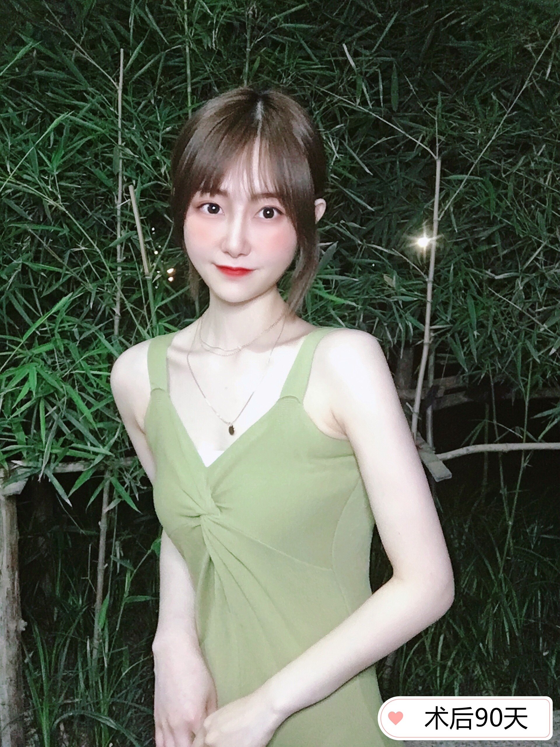 手臂吸脂—轻松拥有天鹅臂!