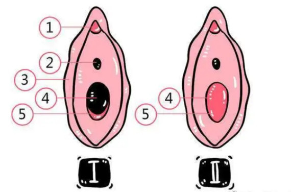 现在处女膜修复手术非常流行,已经成为了女性婚前试爱的一种补救方法.