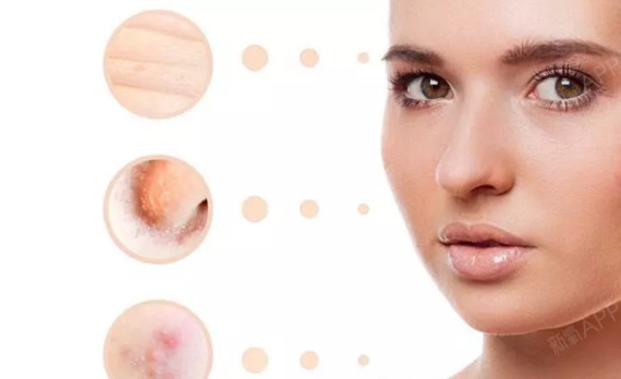 "医生,我好害怕做完双眼皮变成疤瘌眼, 我是瘢痕体质吗?