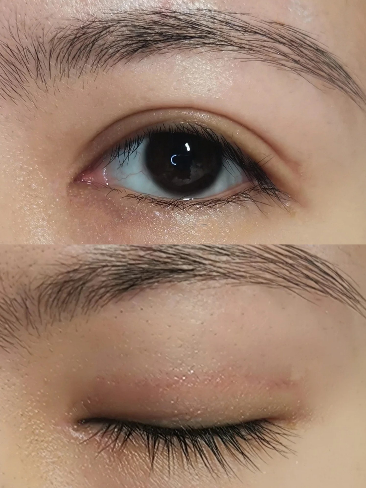 做的双眼皮能自然到什么程度