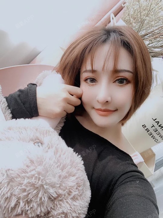 脂肪填充,鼻基底已经没感觉,最近的皮肤还这么好,超级