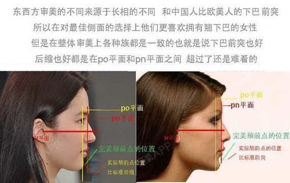 侧颜好看有哪些美学标准侧貌美学分析2