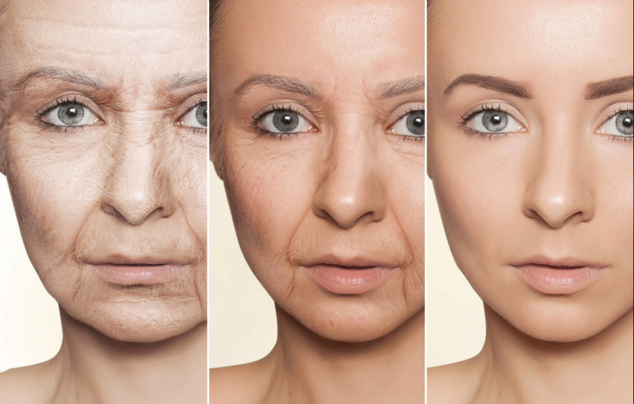 面部老化的3三种表现,看看你自己中了几条?1,皱纹