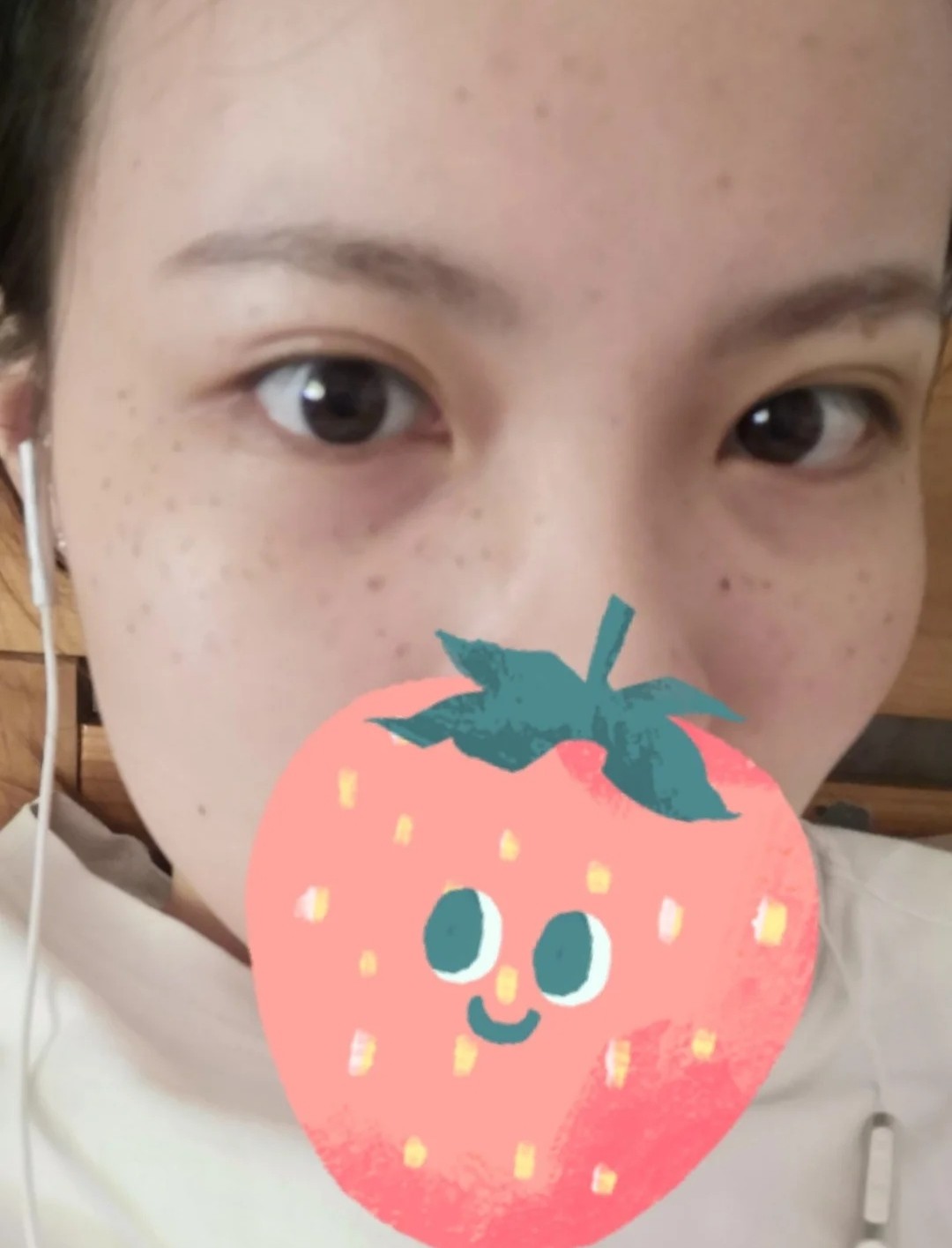 激光祛斑第三天,脸上的黑色斑点暂时还没有掉下来的迹_圈子-新氧美容