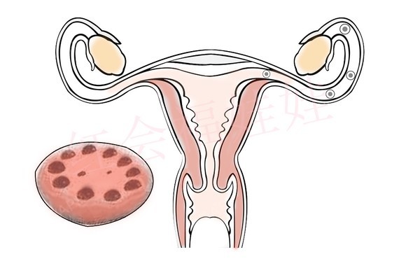 卵巢功能低试管成功率，月经不来