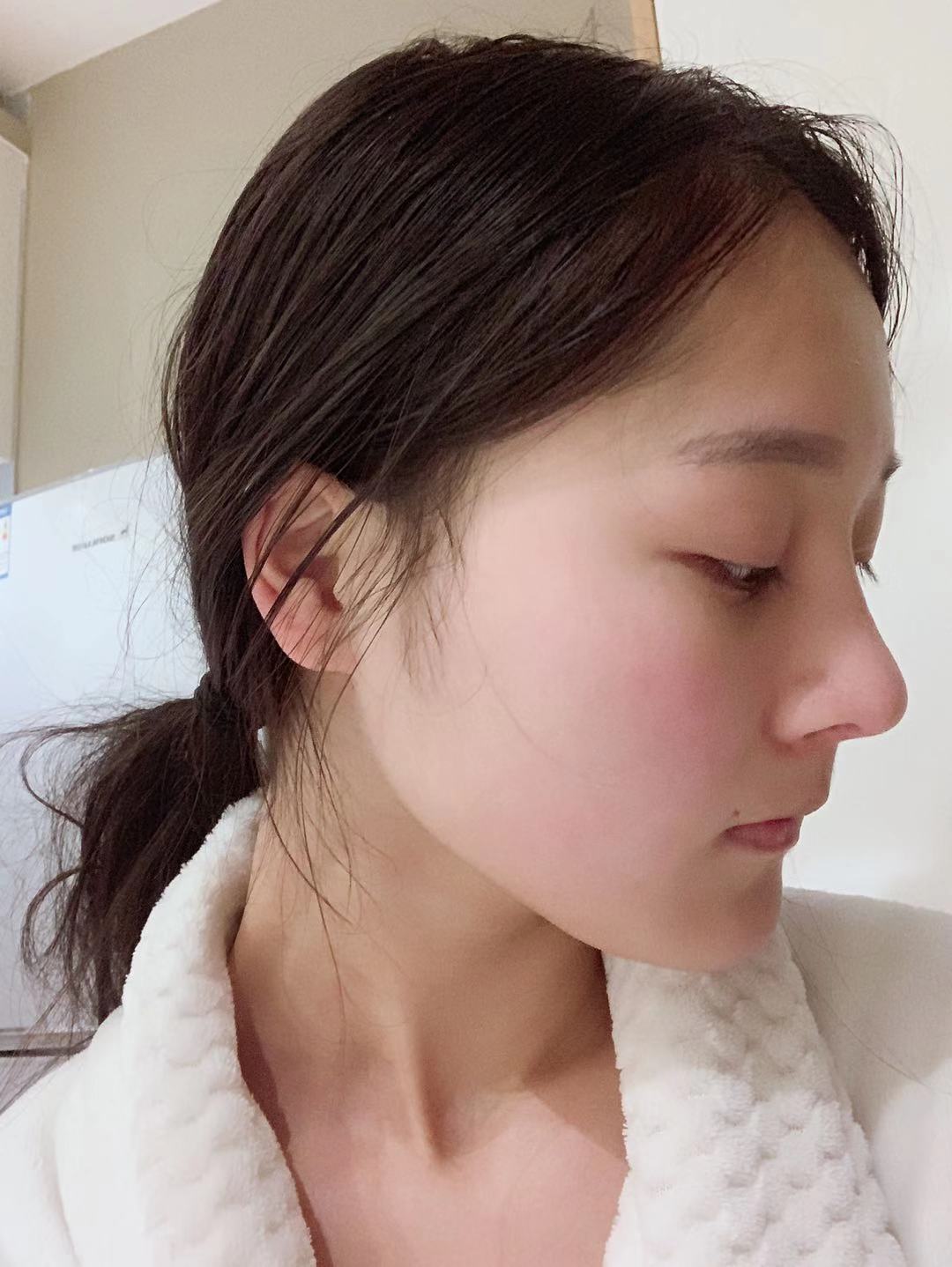 都是低鼻,为什么你的鼻部多项更贵一点