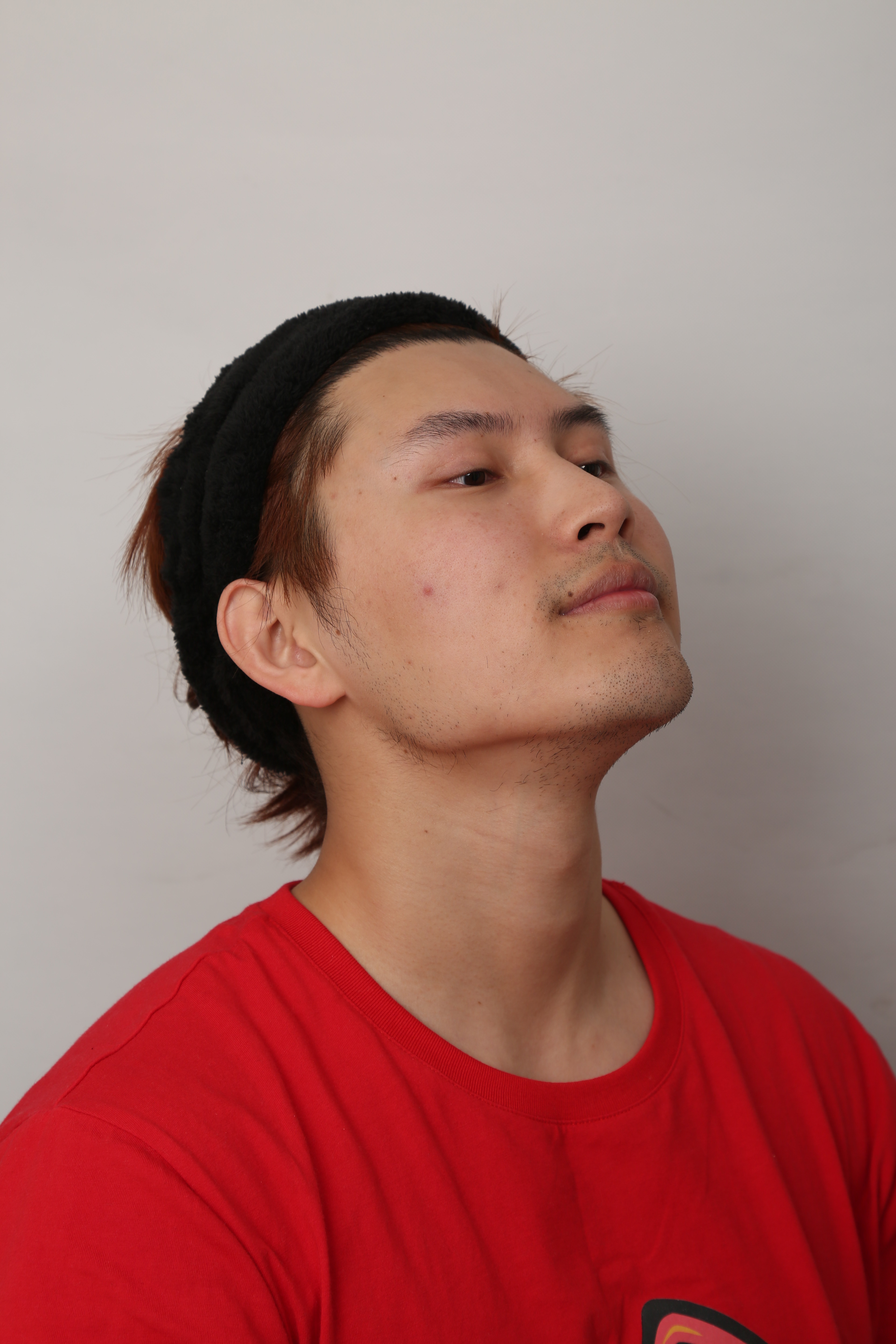 我的鼻子数钱真的很低矮,本身_圈子-新氧美容整形